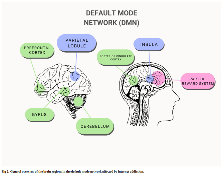 Fig 2. General overview of the brain regions in the default mode network affected by internet addiction.