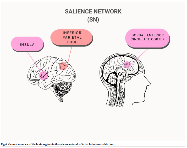 Fig 4. General overview of the brain regions in the salience network affected by internet addiction.